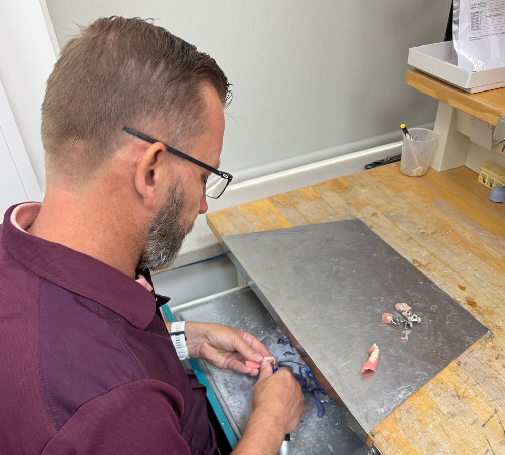 Kunstgebit Reparatie binnen één dag Den Helder
